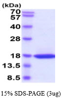 3 μg by SDS-PAGE under reducing condition and visualized by coomassie blue stain.